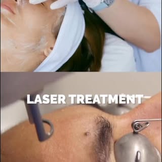 #ａｅｓｔｈｅｔｉｃ #skincareroutine