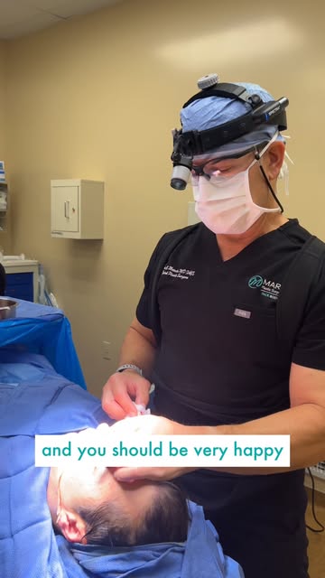 The best rhinoplasty results still look like you, just more balanced! 👃✨

This male patient wanted 