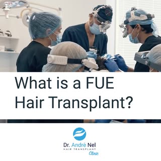 ➡️What is a FUE Hair Transplant?

If you’re considering hair restoration, you’ve probably come acros