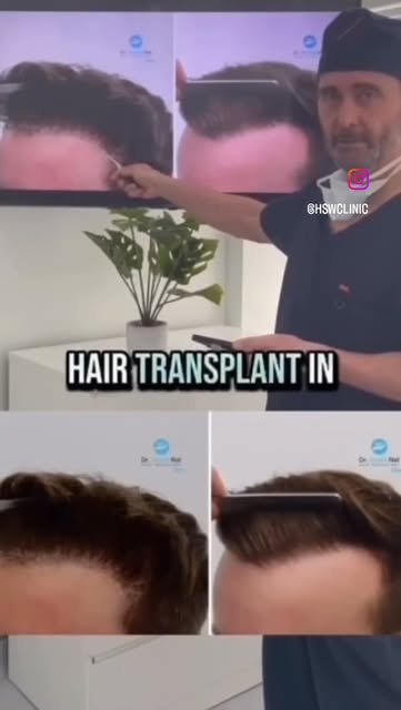 Repairing A Botched Hair Transplant

 In this video Dr. Andre Nel talks about repairing a botched ha