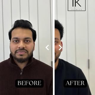 When we say we are in the business of transformation this is what we mean. 

This FUE has restored n