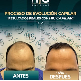 Un año puede hacer una gran diferencia cuando tomas la decisión correcta. ✨

Agenda tu valoración y 