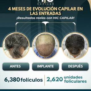 Sí, entiendo: quieres que el copy no se limite a describir el antes y después, sino que ese cambio s
