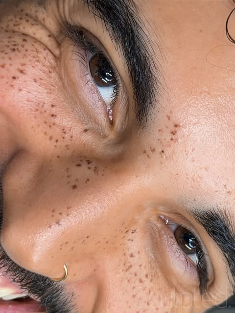 Let’s talk Sculpted Freckles ☀️ because fresh freckles have a little main-character energy before th