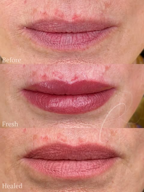 Complex lips don’t always mean a complex corrections or multi-tonal lips.

Sometimes the complexity 