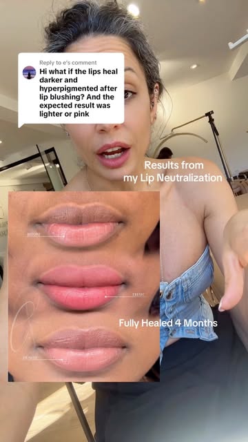 What is happing when your lip tattoo (Lip Blushing, Lip Neutralization, Lip Brightening) isn’t heali