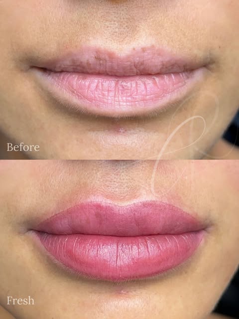 Some lips just need the right color to come back into balance.

My client had a terrible reaction to