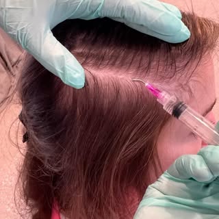 Hair loss isn’t a one-size-fits-all problem—so why would the solution be? 🌱

One of my favorite mom