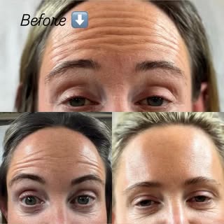 Ok... Yes it is so Natural! That's what you wanted 🫶🏻

Toxin | Anti-Aging | Weybridge | Surrey | B