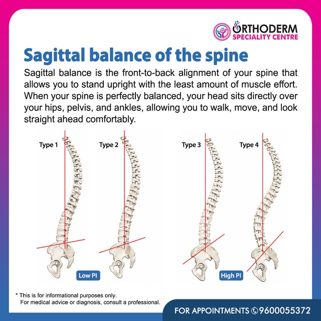 Sagittal Balance of the Spine 🦴

Did you know that your spine needs the right front-to-back alignme