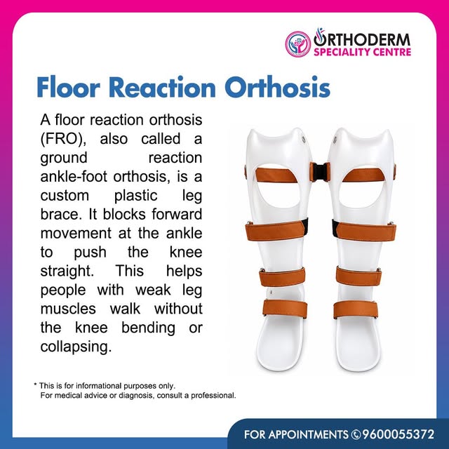 Floor Reaction Orthosis (FRO) – Supporting Better Walking 🦵

A Floor Reaction Orthosis (FRO) is a c