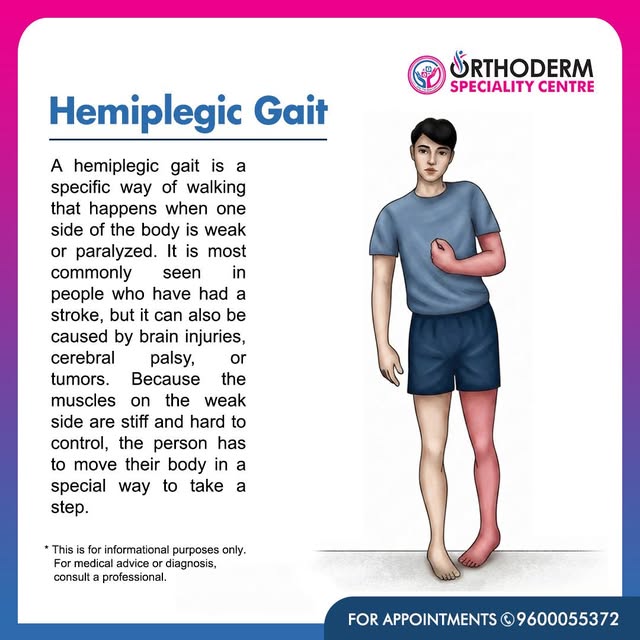 Hemiplegic Gait – When One Side of the Body Becomes Weak 🧠🦵

A hemiplegic gait is an abnormal walk