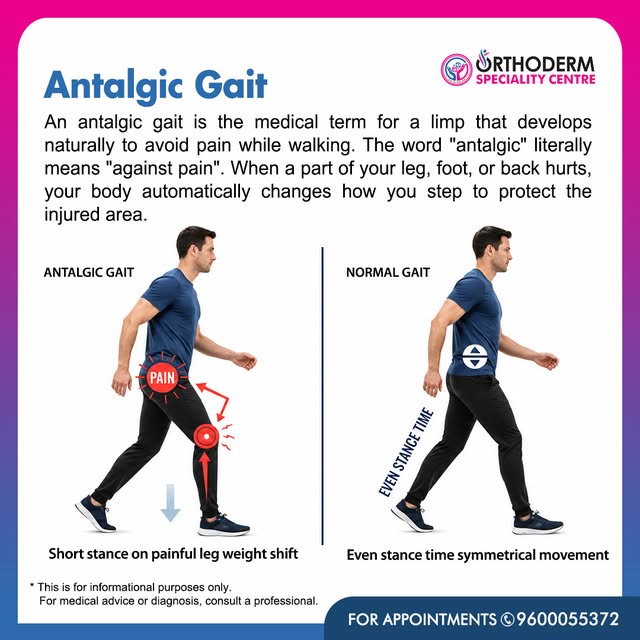Antalgic Gait – Why Do You Limp While Walking? 🦵⚠️

An antalgic gait is a walking pattern that deve