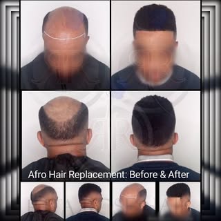 I enjoyed every moment of this transformation #mondaymotivation #Afro #hairlove #blessed #nonsurgica