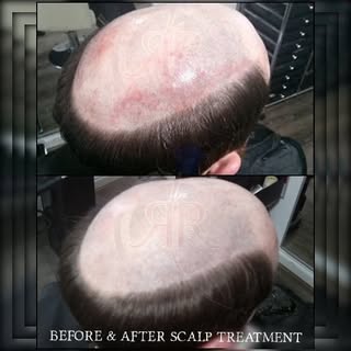 Here at Rita Rose Hair, the health of your hair & scalp is of utmost importance. Ignoring conditions
