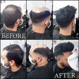 If it isn't the best, I cannot rest!!! Expert hair loss transformation by Rita Rose Hair. Book onlin