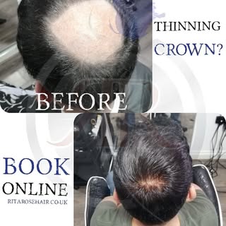 We continue to care about service! Online enquires at www.ritarosehair.co.uk

#nonsurgicalhairreplac
