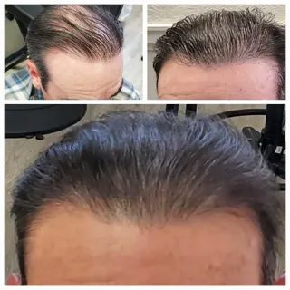 Male density build