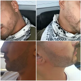 Beard Density Build