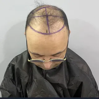 A new look, a fresh start! 

Discover this incredible transformation crafted by expert hands. Every 