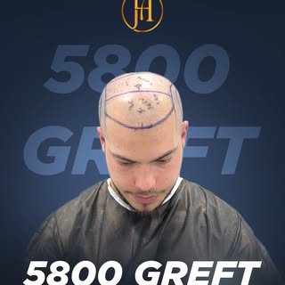 Achieve the hair of your dreams with Hair House! 

Discover Turkey’s innovative and exclusive hair t