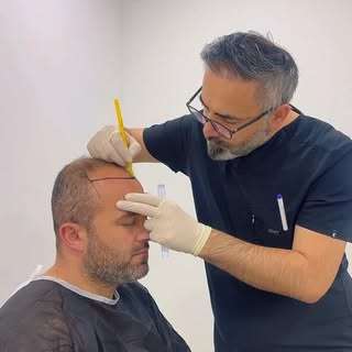 Now is the time to turn back the clock, don’t wait any longer.

📳 +90545 822 34 05

#fue#hair#hairt