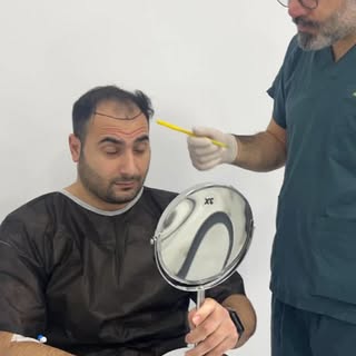 The change is beginning, new hair is not far away

📳 +90545 822 34 05

#fue#hair#hairtransformation