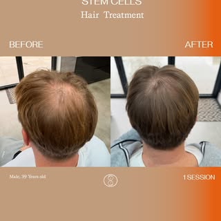 Real results. One treatment. Three months later.

Our patient's transformation just 3 months after a