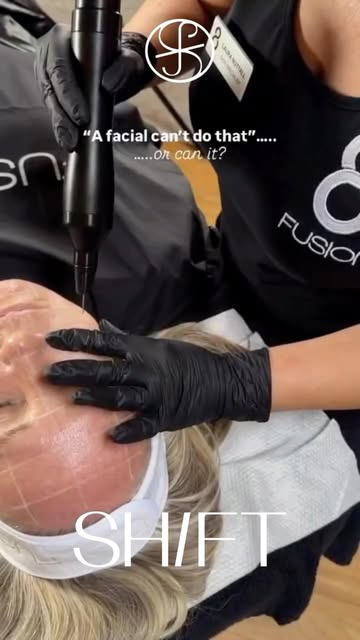 Meet the Fusion 8 Plasma.
A fantastic treatment for resurfacing and rejuvenating the skin, helping t