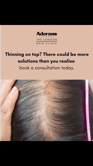 Thinning on top? There could be more solutions than you realise. 

Whatever the cause or stage of yo