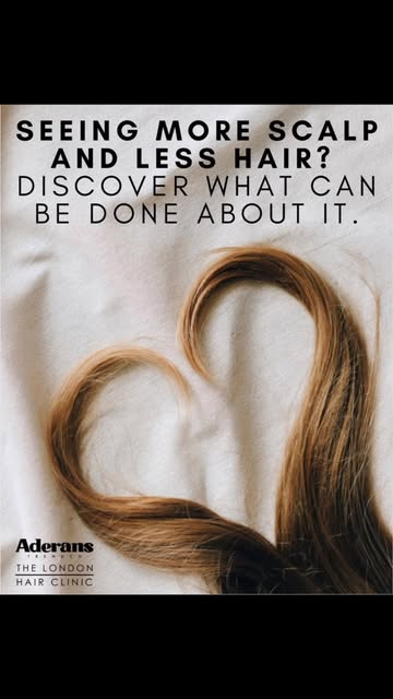 Seeing less hair and more scalp? It could be time to discover what can be done about it.

Female hai