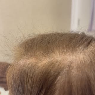 Você acha que esse tratamento começou com um laser?

Spoiler: não começou.

Tudo começou aqui.

Ante