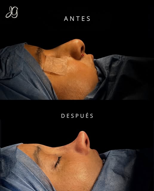 Hay cambios que se notan a simple vista y otros que sorprenden por su perfecta armonía y naturalidad