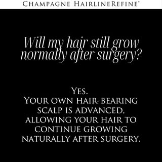 One of the questions I hear most often is, “Will my hair still grow normally after hairline lowering