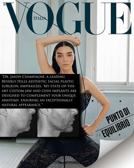 Honored to be featured in @VogueItalia for my work with custom chin and jaw implants.

A strong, wel