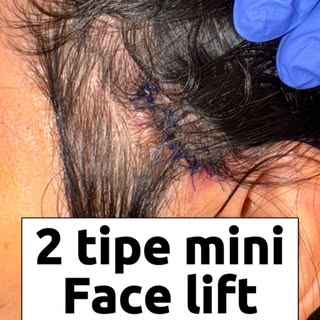 Varian facelift ada banyak banget. Tapi yg kita kerjakan, ini menurut kita simple tapi high impact. 