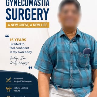 At the age of 55, this patient from Visakhapatnam finally decided to undergo Gynecomastia Surgery af