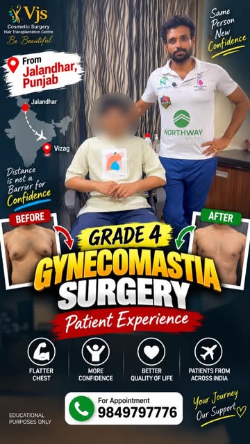From Jalandhar, Punjab to Vizag for Grade 4 Gynecomastia Surgery! ✈️💪

A patient travelled all the 