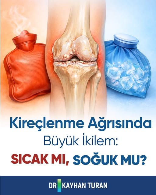 Dizleriniz "paslanmış" mı yoksa "yanıyor" mu? 🔥❄️

Kireçlenme (osteoartrit) hastalarından en çok du
