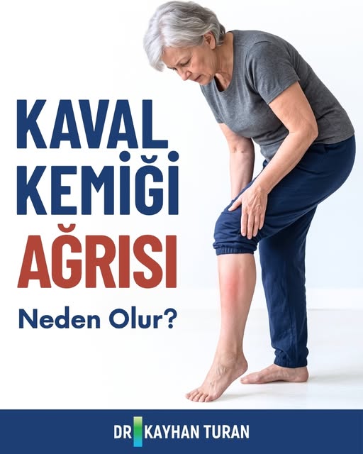 Kaval kemiği ağrınız basit bir kas ağrısı mı, yoksa daha ciddi bir şey mi? 🦵
Zar İltihabı, stres kı