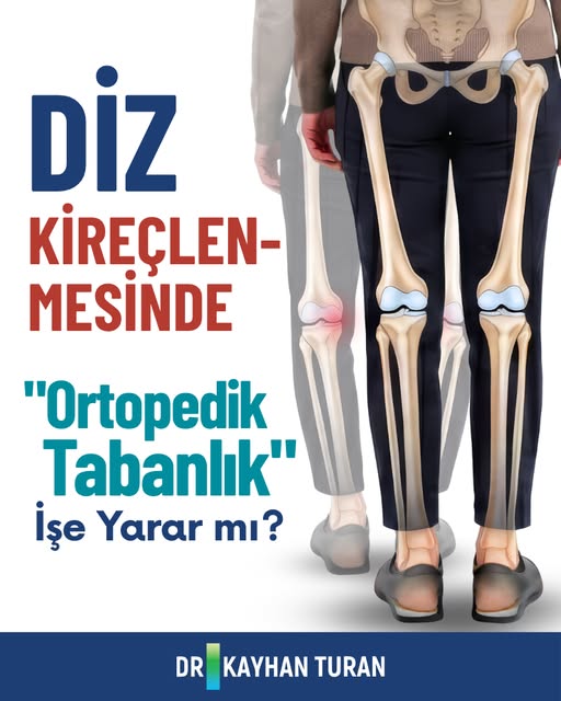 Diz kireçlenmesinde ortopedik tabanlık işe yarar mı? 🦵

Kısa cevap: Herkese değil — ama doğru hasta
