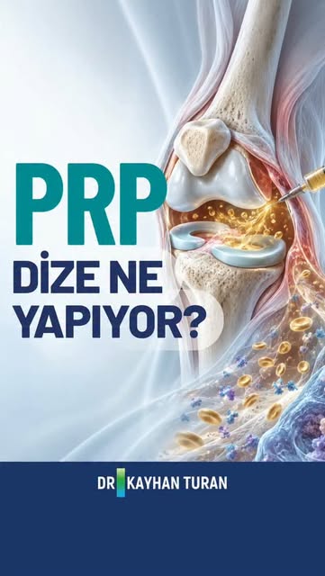 🚨 "Dizime PRP yaptırsam gerçekten işe yarar mı? Eklem içinde tam olarak ne değişiyor?" 🛑

Diz kire