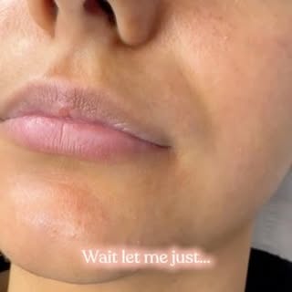 Wait, let me just enhance these lips 👄

Transformations don’t have to be dramatic. By respecting th