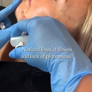 Profhilo is a skin booster designed for deep hydration and collagen stimulation to remodel what’s al