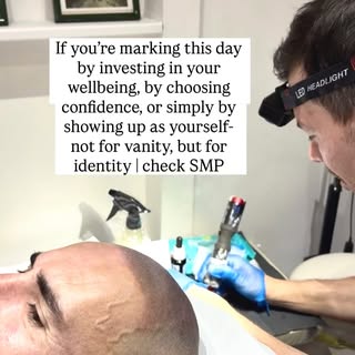 Scalp Micropigmentation is more than a cosmetic treatment. It’s a way to give men back a sense of co
