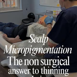 Scalp Micropigmentation (SMP) — the non-surgical answer to thinning hair. 🤍 Swipe to discover what 