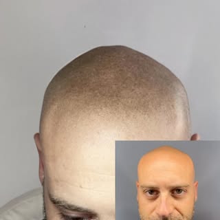 Every scalp is different, every story is unique, and every treatment is tailored to achieve the most