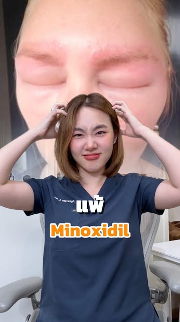 นี่คืออาการของคนที่แพ้ Minoxidil
