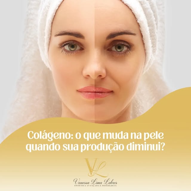 O colágeno é uma das proteínas importantes para a estrutura, firmeza e sustentação da pele.

Com o p