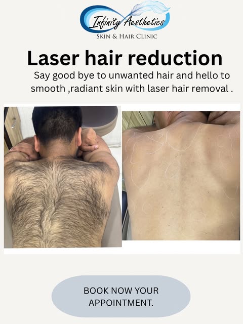 ✨ Laser Hair Reduction Caption

Say goodbye to the hassle of unwanted hair! ✨
Experience smoother, s